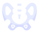 Prótesis de revisión de cadera o Artroplastia de revisión de cadera